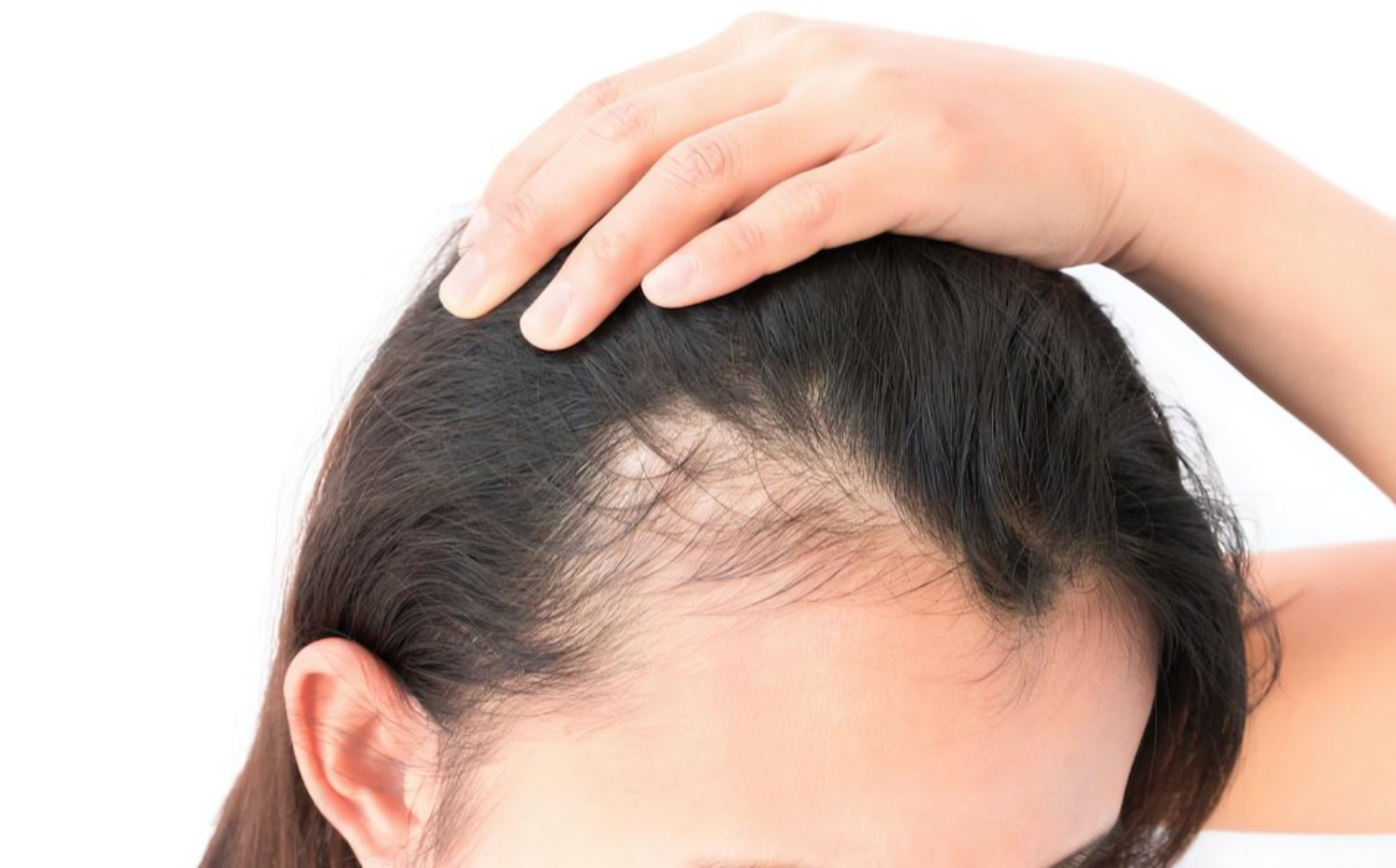 Are you suffering from thinning hair? So first know the reason and then take care की तस्वीर
