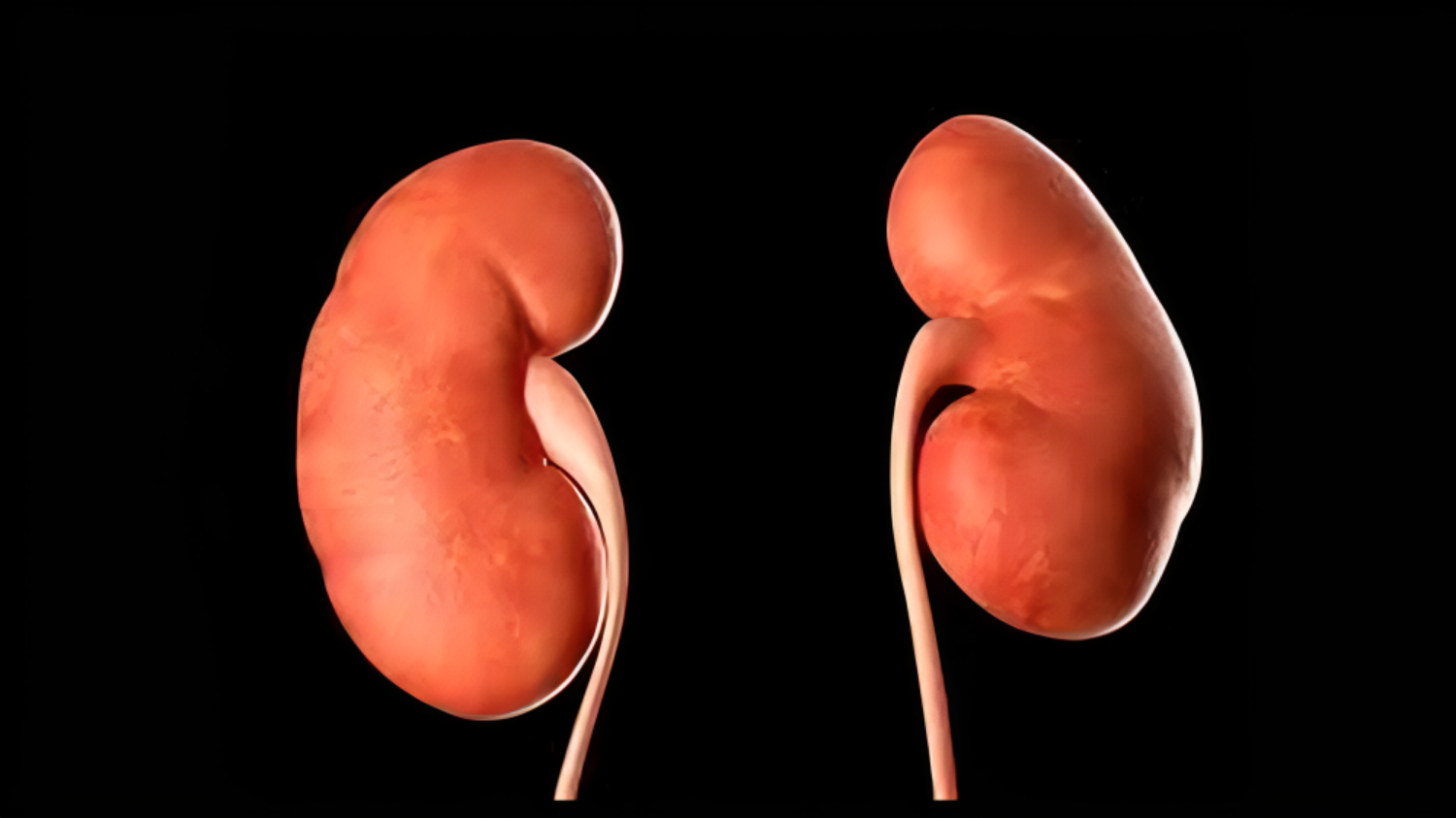 World Kidney Day 2024: Increased creatine levels can lead to kidney failure, know how to control it? की तस्वीर